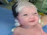 ولادة طفل في لبنان بشعر شايب